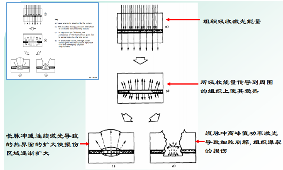激光投影安全吗?有评价标准吗?